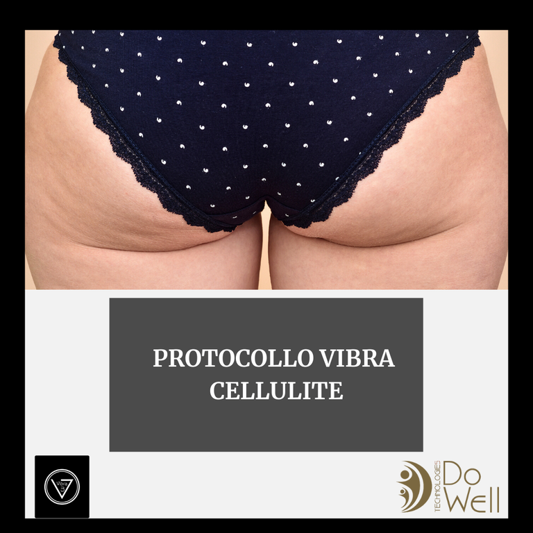 Protocollo Cellulite