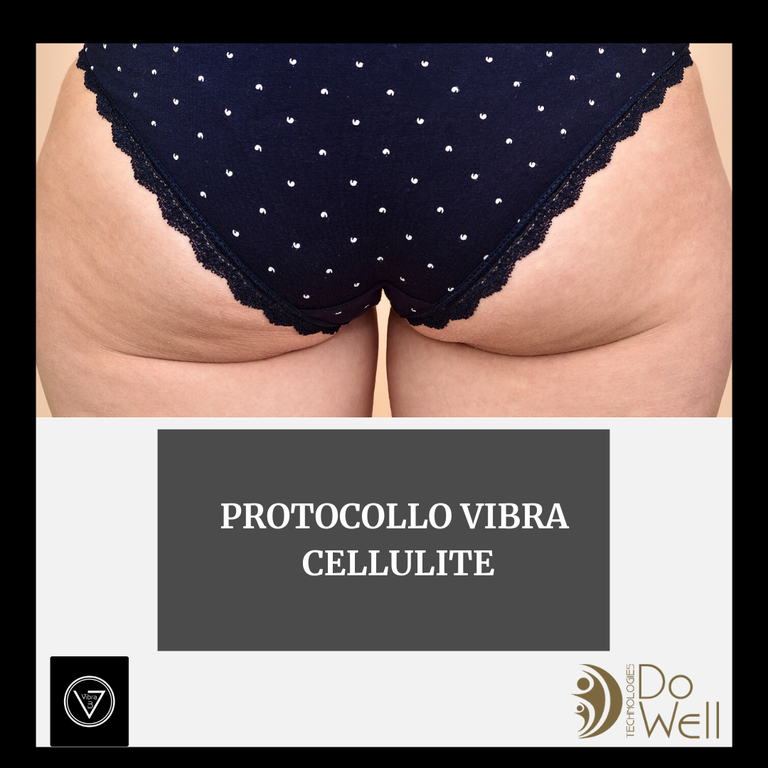 Cellulite Protocol