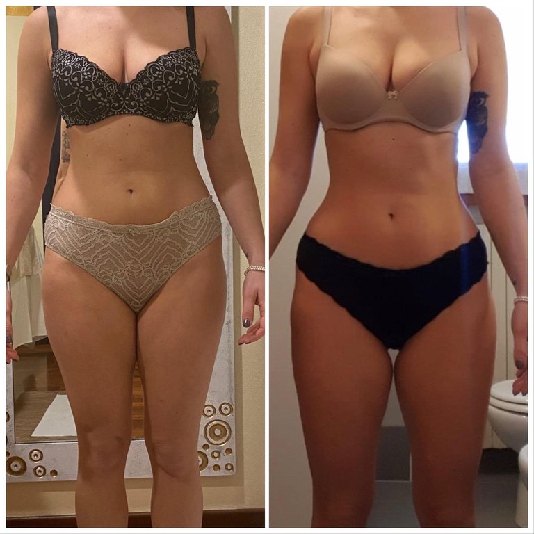 WORK IN PROGRESS FOR A BODY TREATMENT: CELLULITE PROGRAM AFTER 2 SESSIONS