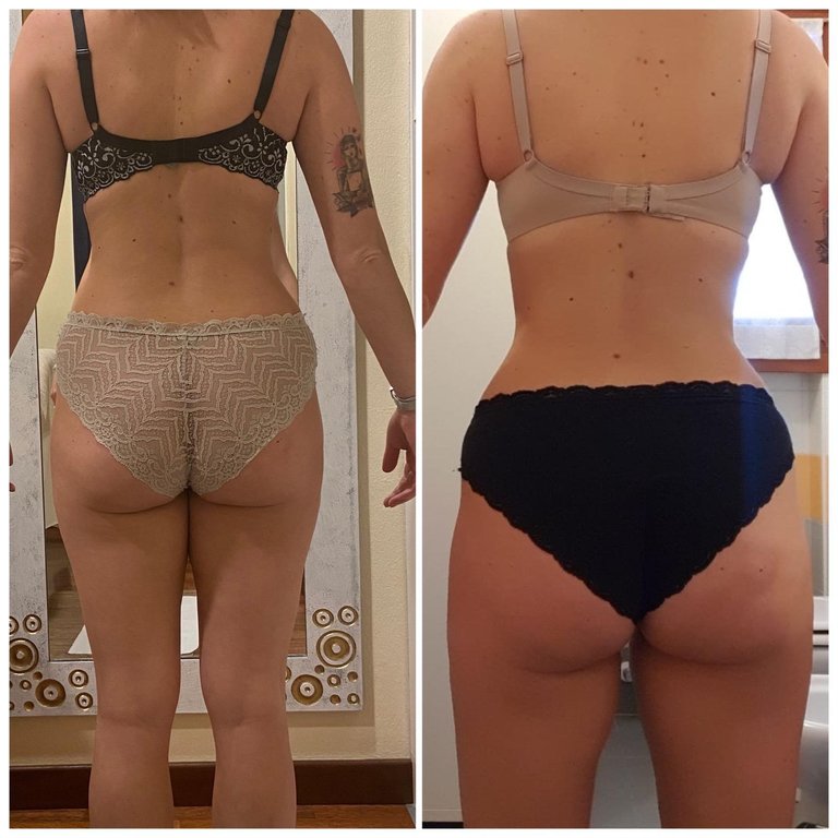 WORK IN PROGRESS FOR A BODY TREATMENT: CELLULITE PROGRAM AFTER 2 SESSIONS