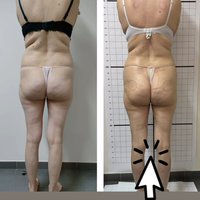 Prima Vibra Beauty in Sicilia, presso il Centro Dermoestetico Antonella