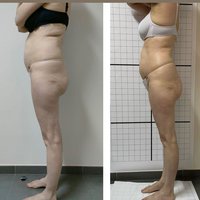 Prima Vibra Beauty in Sicilia, presso il Centro Dermoestetico Antonella